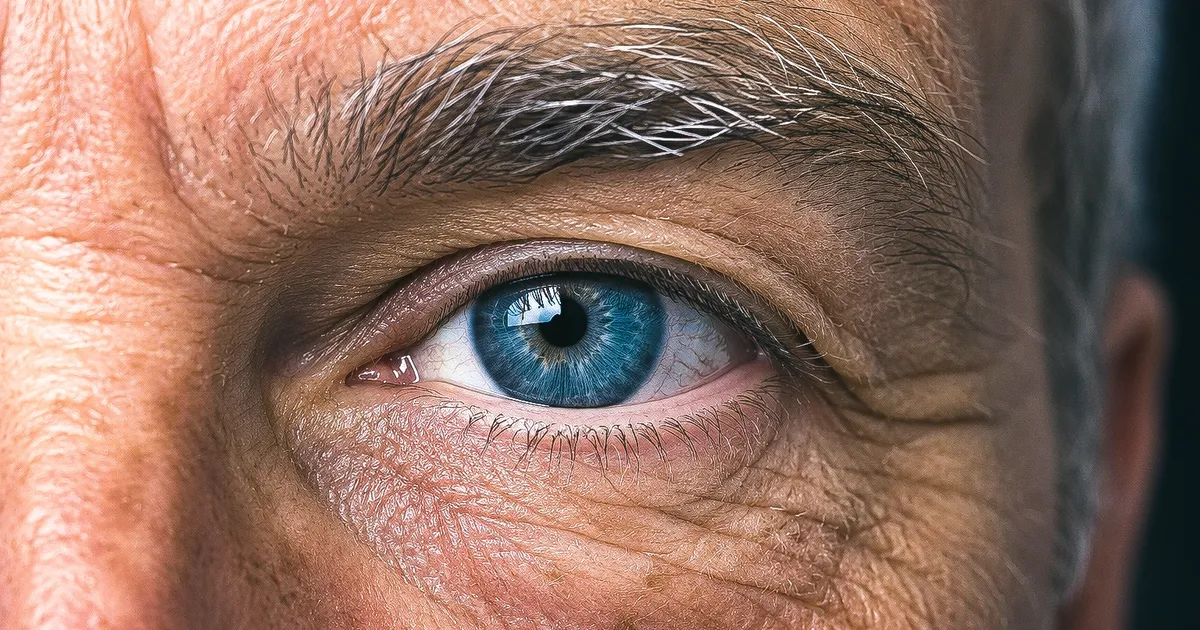 57 year eye