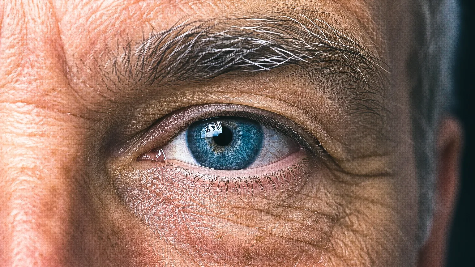 57 year eye