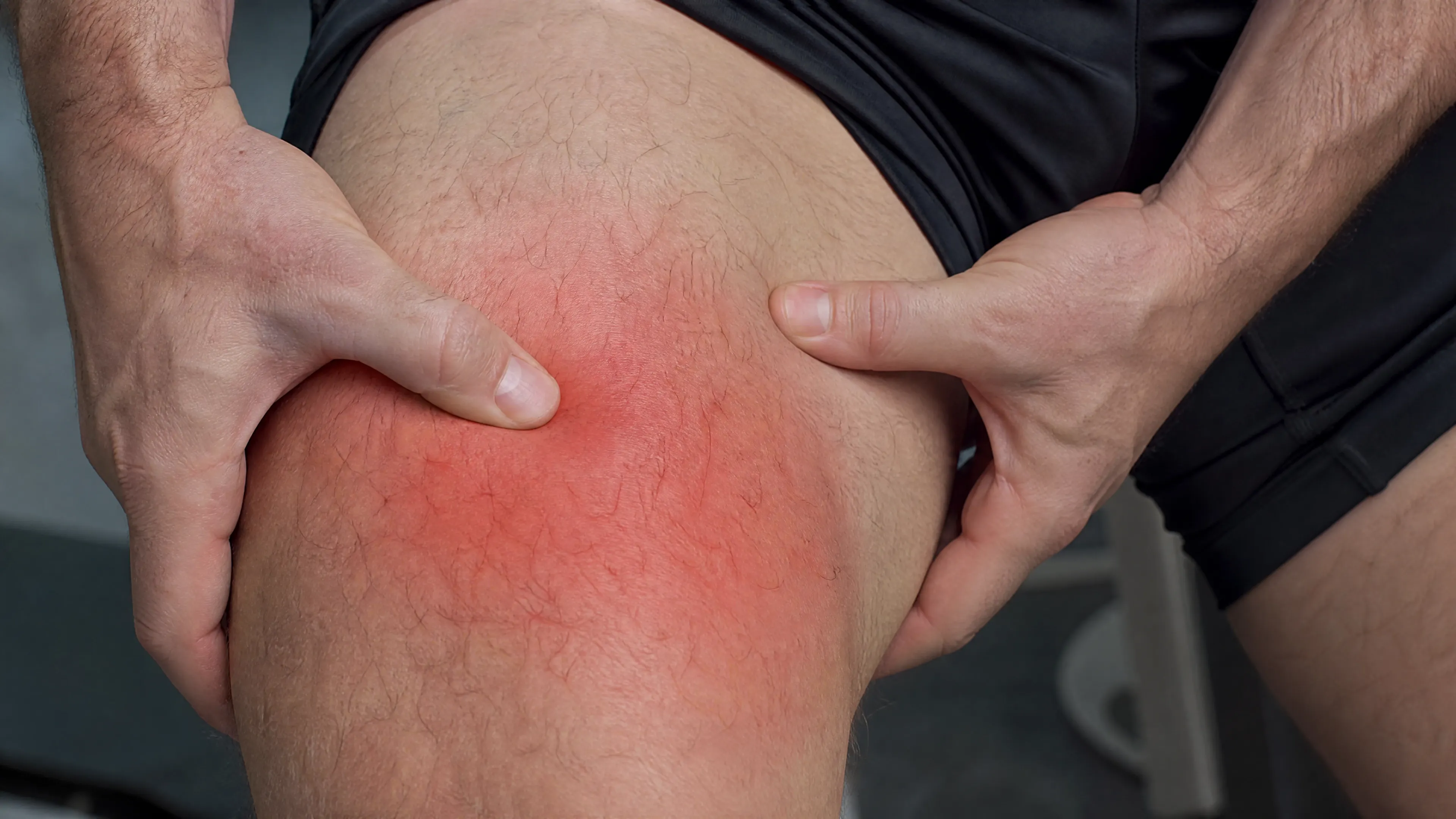 muscle pain