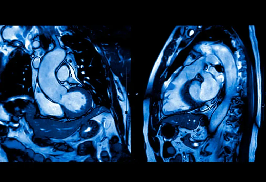 cardiac magnetic